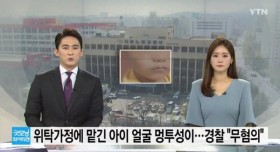 위탁가정에 맡긴 아이 얼굴에 멍투성이...